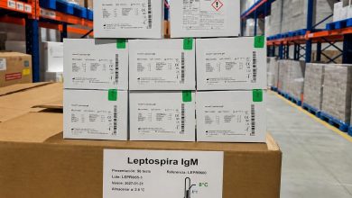 Minsa adquirió mil kits para diagnóstico de leptospirosis ante lluvias intensas