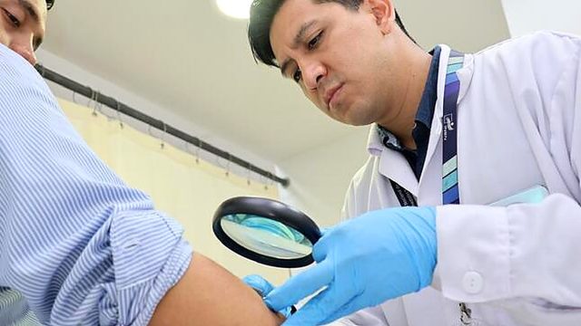 Ministerio de Salud orienta sobre manchas en la planta de los pies como posibles signos de cáncer de piel